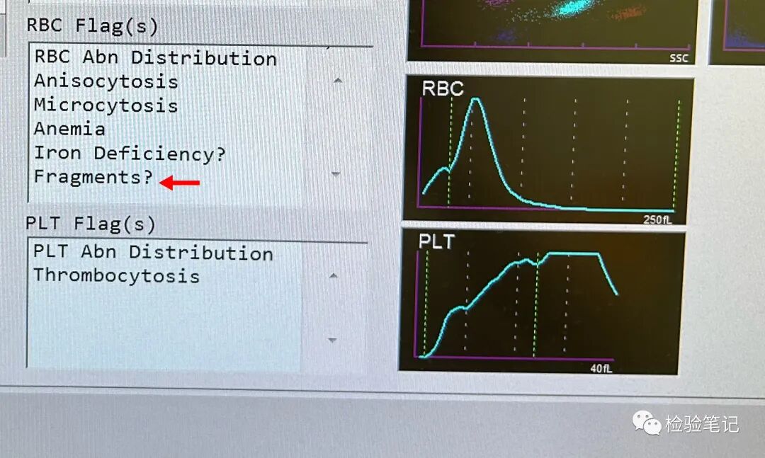 rbc直方图怎么看“实战演练”——用血常规散点图判断异常结果_https://www.jmylbn.com_新闻资讯_第22张