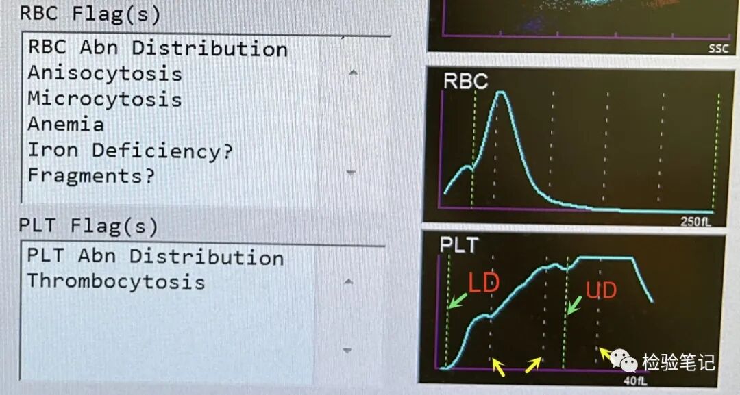 rbc直方图怎么看“实战演练”——用血常规散点图判断异常结果_https://www.jmylbn.com_新闻资讯_第28张