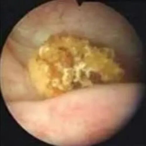 b膀胱镜为什么消毒为什么医生建议你查膀胱镜？附：检查前后注意事项_https://www.jmylbn.com_新闻资讯_第3张