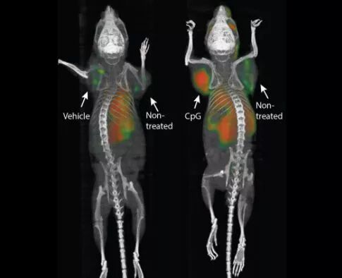 ˹̹Ƴɰ֢ - "ԭλ"Insitu Vaccination)