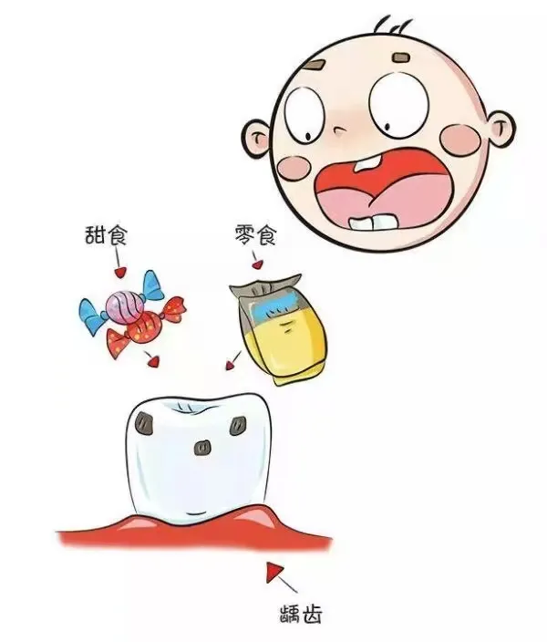 涂氟防蛀牙，为宝宝的牙齿穿上保护衣！