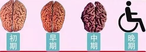 脑供血不足头晕偏方！-古方玉灵膏-贡轩园天然守真。