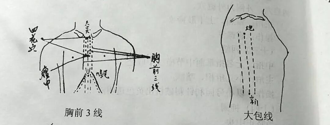 导什么针什么很多中医人都不了解的医学瑰宝，濒临失传的“古九针”之一【鍉针导引疗法】附实操视频_https://www.jmylbn.com_新闻资讯_第5张