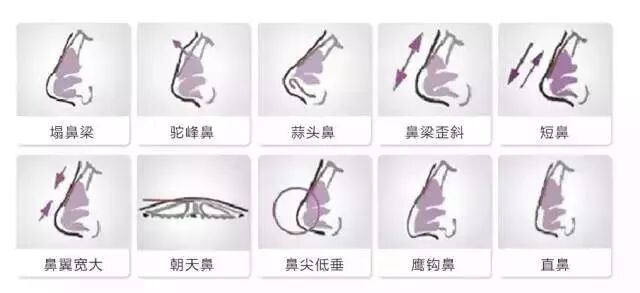 30万的双眼皮为什么大家排队都在抢着做 新一番雪莲花云平台 微信公众号文章阅读 Wemp