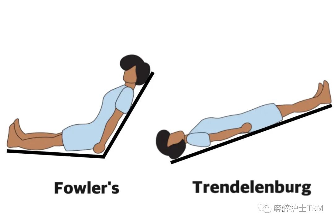 怎么呼吸麻醉麻醉和手术体位 - 呼吸系统的影响_https://www.jmylbn.com_新闻资讯_第10张