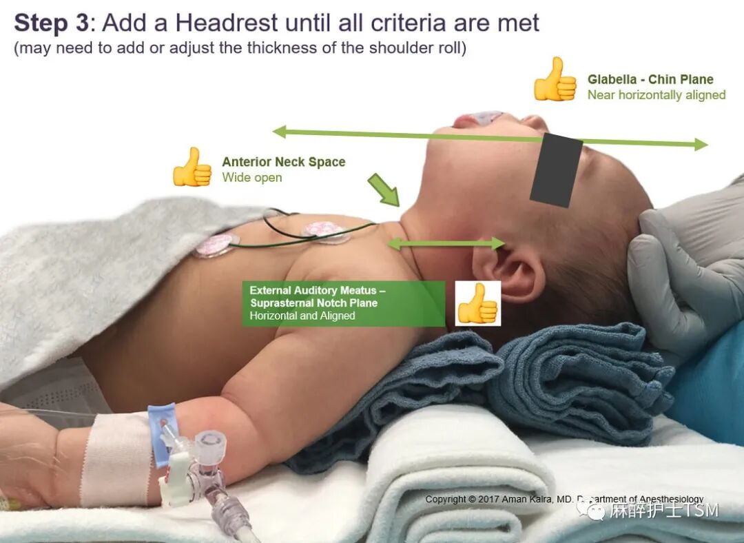 怎么呼吸麻醉麻醉和手术体位 - 呼吸系统的影响_https://www.jmylbn.com_新闻资讯_第20张