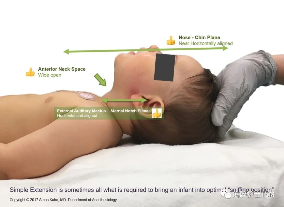 怎么呼吸麻醉麻醉和手术体位 - 呼吸系统的影响_https://www.jmylbn.com_新闻资讯_第17张