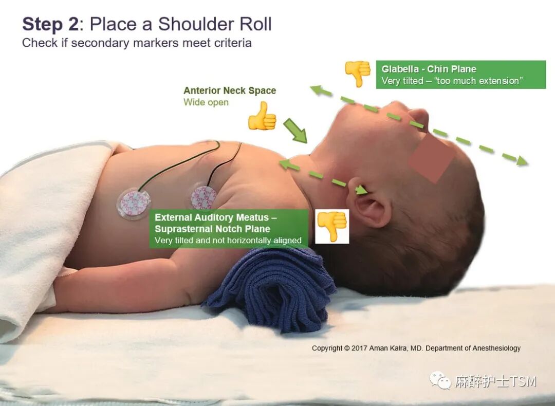 怎么呼吸麻醉麻醉和手术体位 - 呼吸系统的影响_https://www.jmylbn.com_新闻资讯_第18张