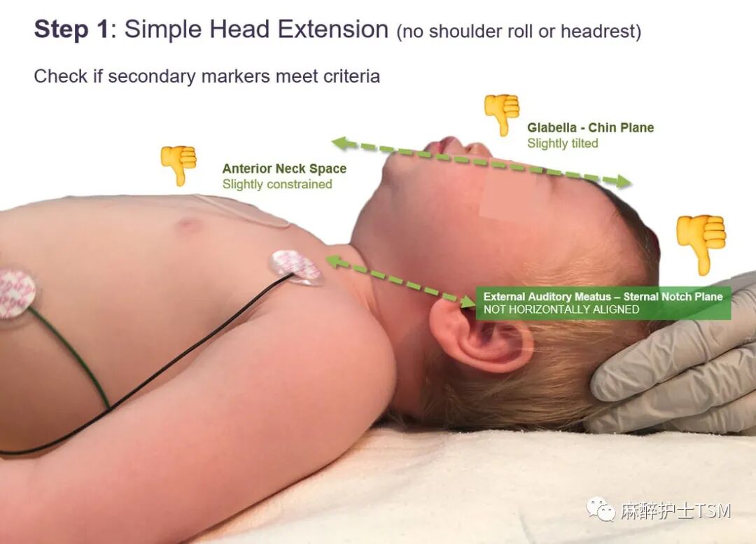 怎么呼吸麻醉麻醉和手术体位 - 呼吸系统的影响_https://www.jmylbn.com_新闻资讯_第15张