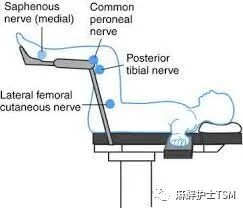 怎么呼吸麻醉麻醉和手术体位 - 呼吸系统的影响_https://www.jmylbn.com_新闻资讯_第9张
