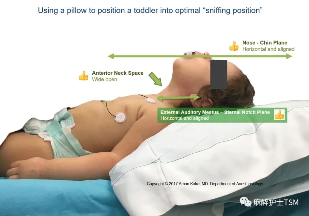 怎么呼吸麻醉麻醉和手术体位 - 呼吸系统的影响_https://www.jmylbn.com_新闻资讯_第21张