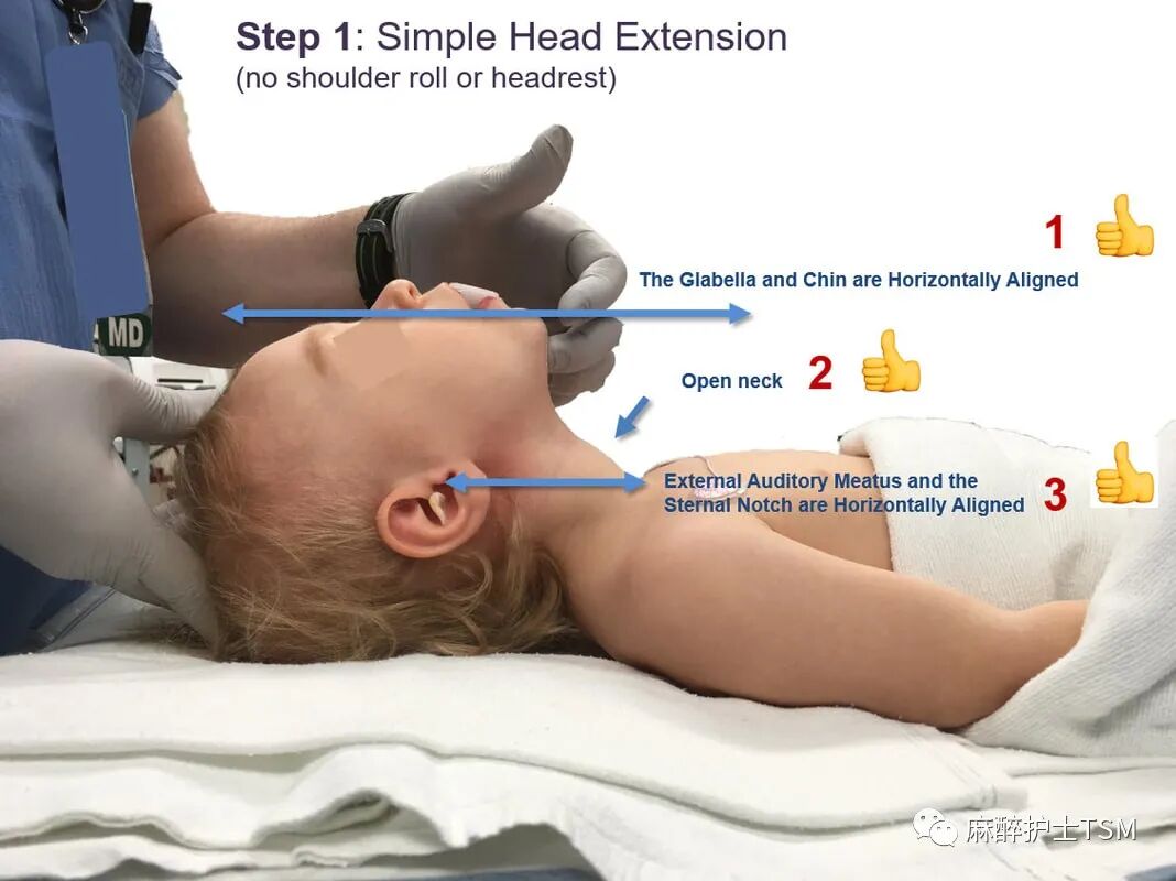 怎么呼吸麻醉麻醉和手术体位 - 呼吸系统的影响_https://www.jmylbn.com_新闻资讯_第16张