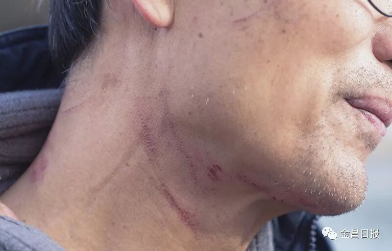 一场与死神赛跑的接力赛——金昌警民联手勇救落入冰窟儿童英雄事