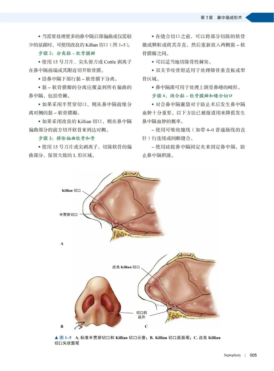 操作鼻窦镜时怎么摆经鼻内镜开展鼻窦颅底手术的具体步骤及操作图谱_https://www.jmylbn.com_新闻资讯_第9张