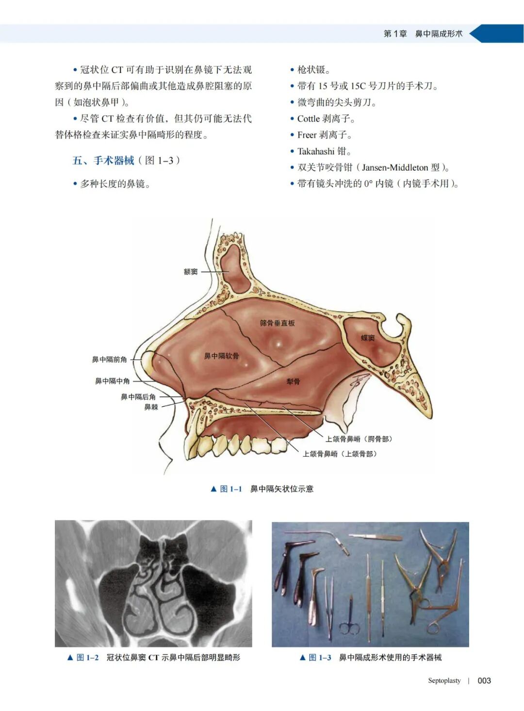 操作鼻窦镜时怎么摆经鼻内镜开展鼻窦颅底手术的具体步骤及操作图谱_https://www.jmylbn.com_新闻资讯_第7张