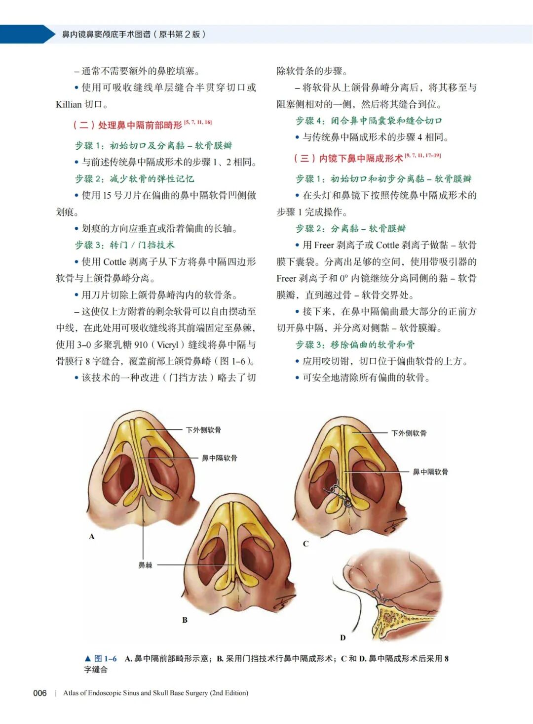 操作鼻窦镜时怎么摆经鼻内镜开展鼻窦颅底手术的具体步骤及操作图谱_https://www.jmylbn.com_新闻资讯_第10张