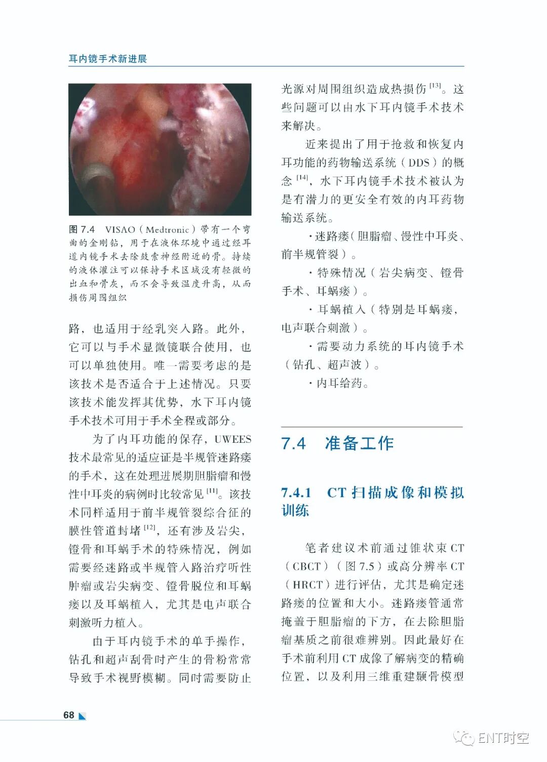 手术电钻怎么用堪称“了不起”的耳内镜手术！术前影像学诊断、耳黏膜及鼓膜再生、电钻和超声骨刀技术......超实用！_https://www.jmylbn.com_新闻资讯_第11张