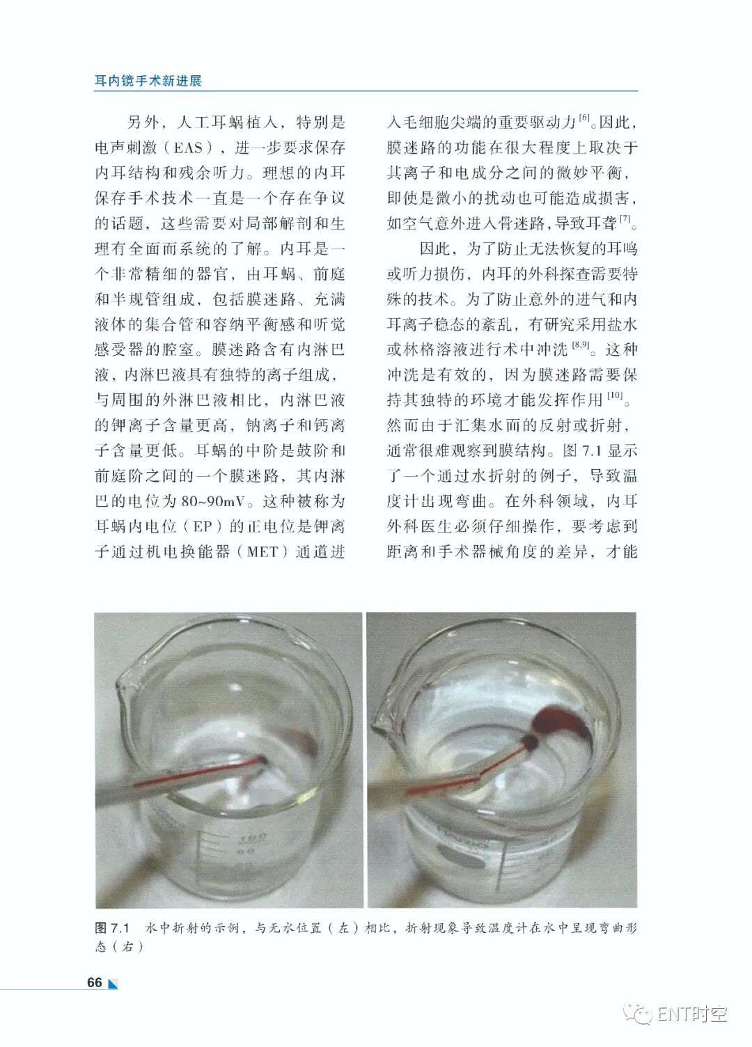 手术电钻怎么用堪称“了不起”的耳内镜手术！术前影像学诊断、耳黏膜及鼓膜再生、电钻和超声骨刀技术......超实用！_https://www.jmylbn.com_新闻资讯_第9张