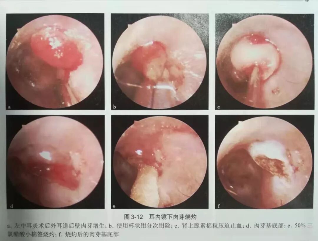 没有耳镜怎么使用耳内镜的基本操作及注意事项_https://www.jmylbn.com_新闻资讯_第13张