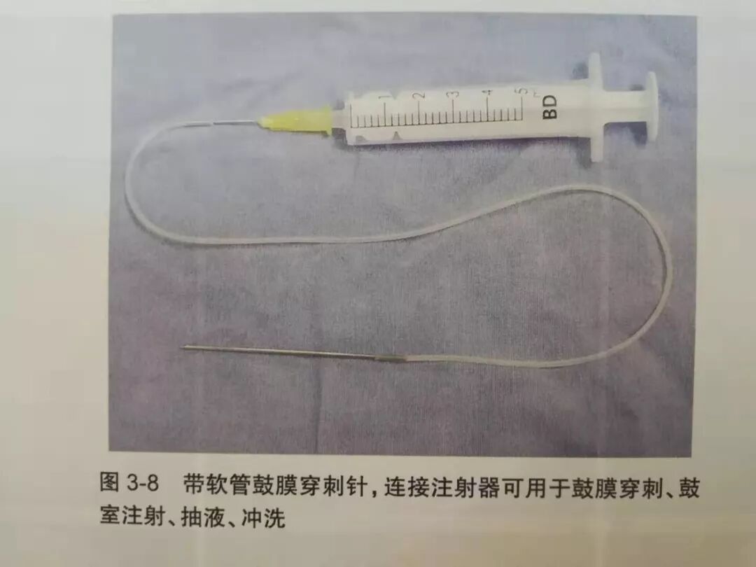 没有耳镜怎么使用耳内镜的基本操作及注意事项_https://www.jmylbn.com_新闻资讯_第9张
