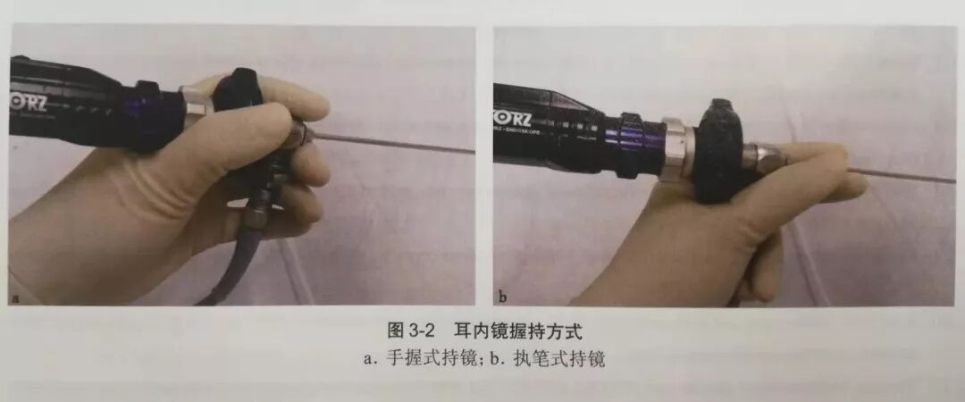 没有耳镜怎么使用耳内镜的基本操作及注意事项_https://www.jmylbn.com_新闻资讯_第2张