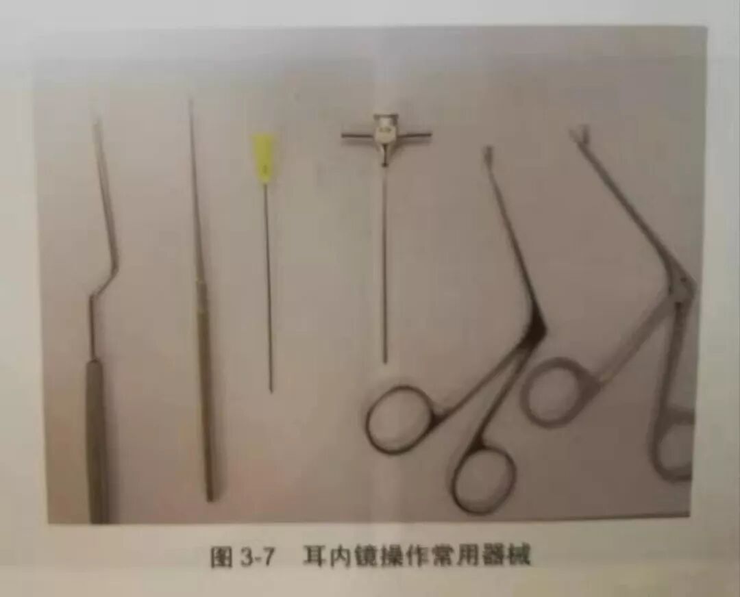 没有耳镜怎么使用耳内镜的基本操作及注意事项_https://www.jmylbn.com_新闻资讯_第8张