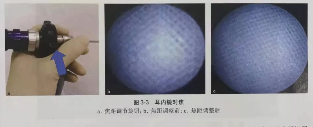 没有耳镜怎么使用耳内镜的基本操作及注意事项_https://www.jmylbn.com_新闻资讯_第3张