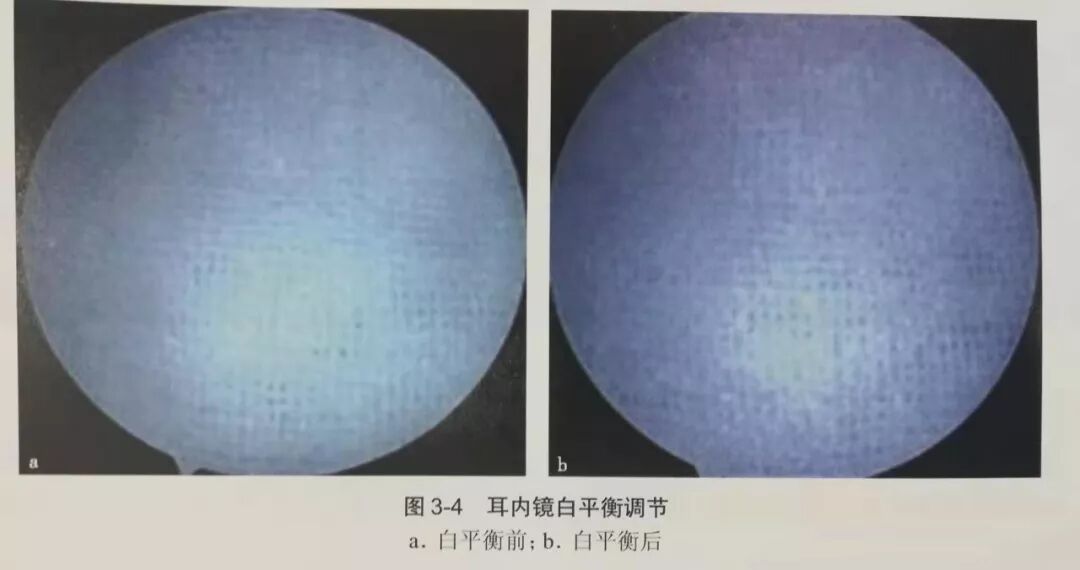 没有耳镜怎么使用耳内镜的基本操作及注意事项_https://www.jmylbn.com_新闻资讯_第4张