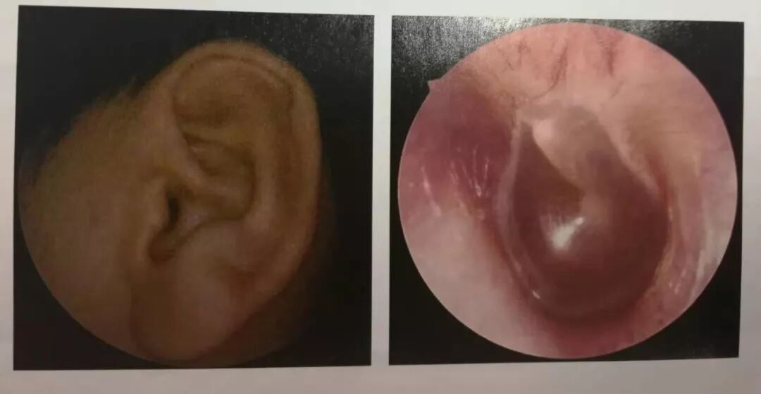 没有耳镜怎么使用耳内镜的基本操作及注意事项_https://www.jmylbn.com_新闻资讯_第5张