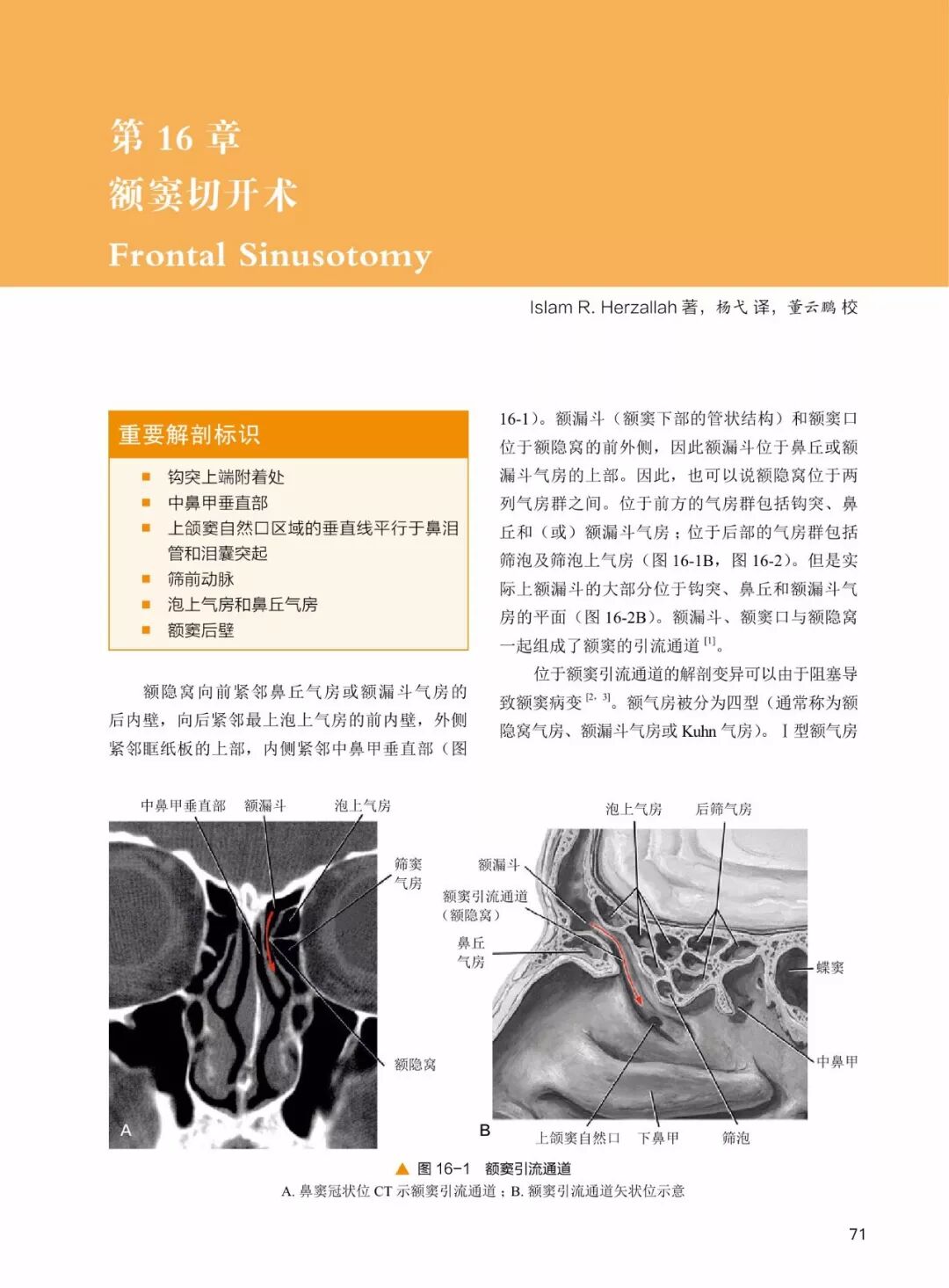 操作鼻窦镜时怎么摆30年鼻内镜手术独特经验！解剖标识、手术径路、外科操作技术还有比这更全的么？_https://www.jmylbn.com_新闻资讯_第11张