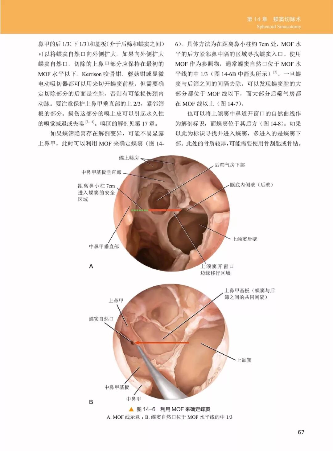 操作鼻窦镜时怎么摆30年鼻内镜手术独特经验！解剖标识、手术径路、外科操作技术还有比这更全的么？_https://www.jmylbn.com_新闻资讯_第9张