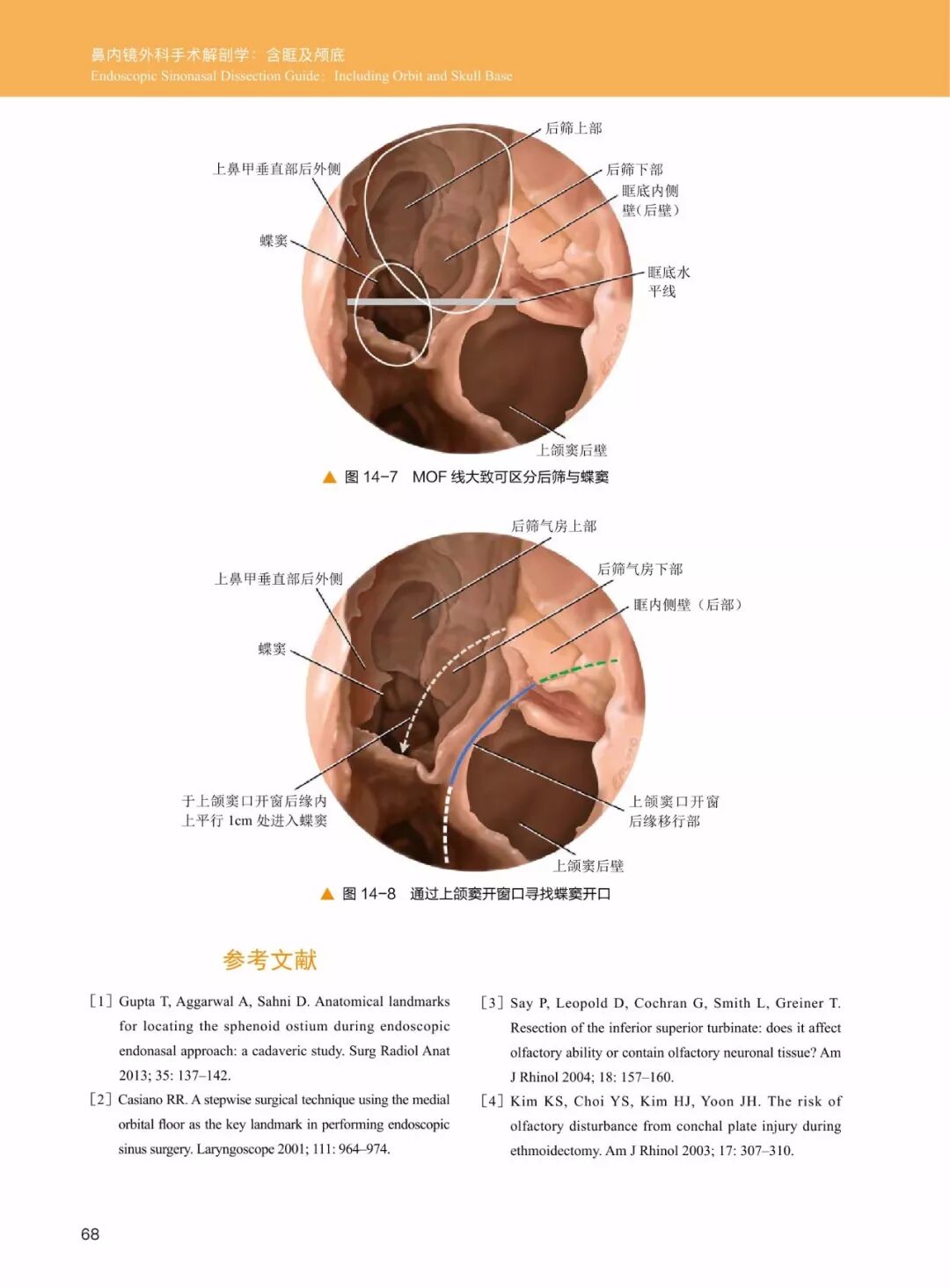 操作鼻窦镜时怎么摆30年鼻内镜手术独特经验！解剖标识、手术径路、外科操作技术还有比这更全的么？_https://www.jmylbn.com_新闻资讯_第10张