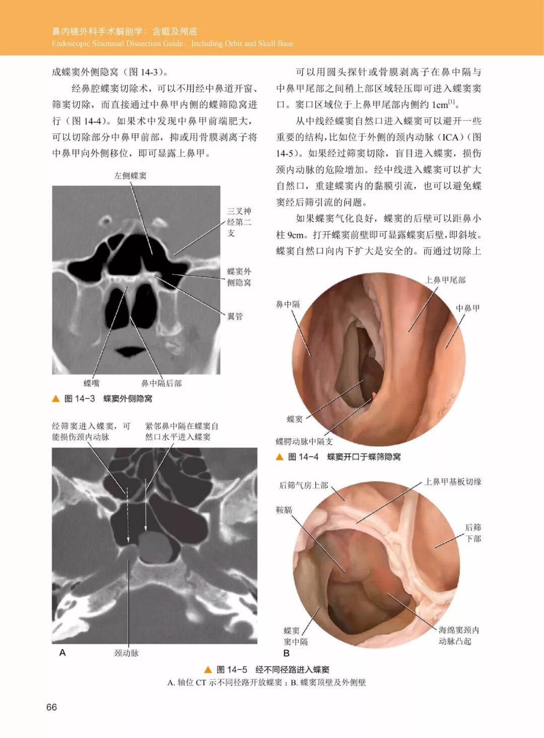 操作鼻窦镜时怎么摆30年鼻内镜手术独特经验！解剖标识、手术径路、外科操作技术还有比这更全的么？_https://www.jmylbn.com_新闻资讯_第8张