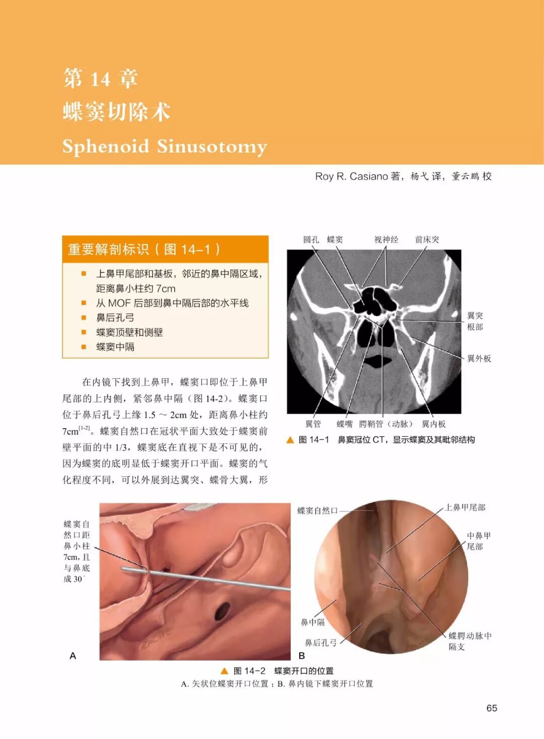 操作鼻窦镜时怎么摆30年鼻内镜手术独特经验！解剖标识、手术径路、外科操作技术还有比这更全的么？_https://www.jmylbn.com_新闻资讯_第7张