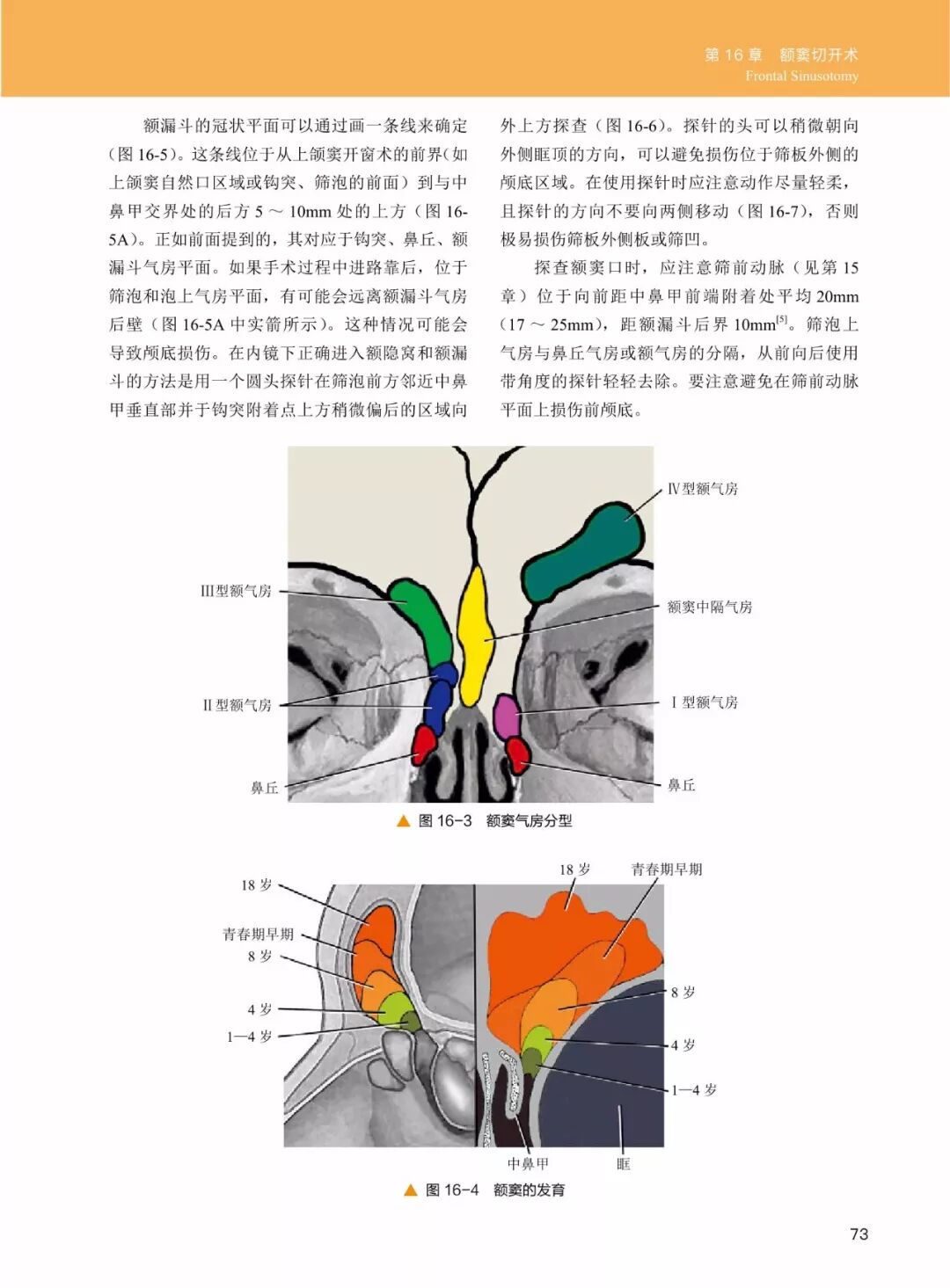 操作鼻窦镜时怎么摆30年鼻内镜手术独特经验！解剖标识、手术径路、外科操作技术还有比这更全的么？_https://www.jmylbn.com_新闻资讯_第13张