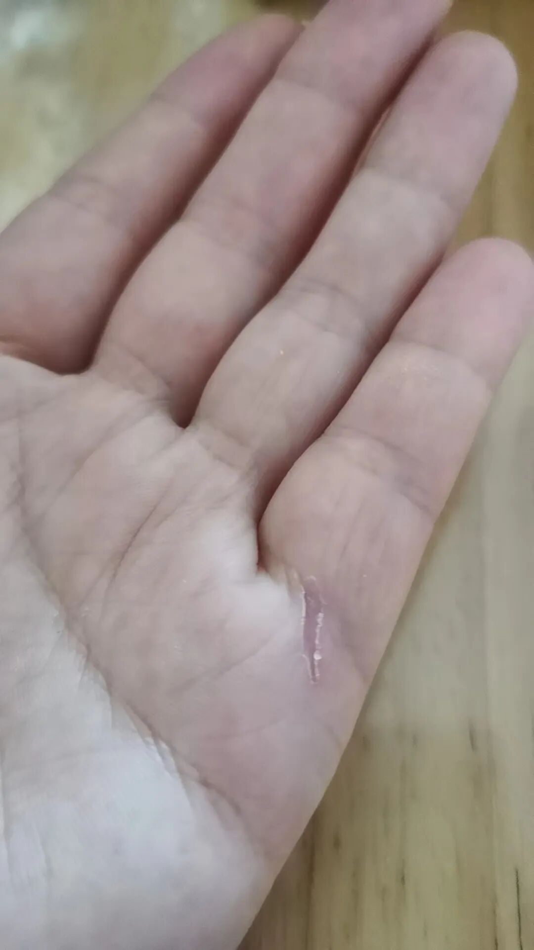 红光治疗什么作用浅谈红光的治疗作用_https://www.jmylbn.com_新闻资讯_第4张