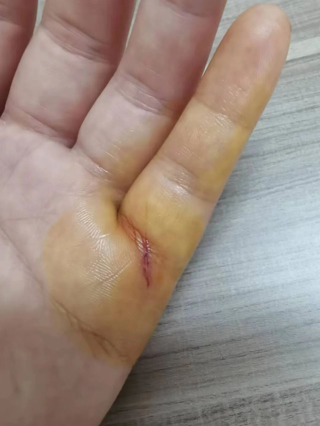 红光治疗什么作用浅谈红光的治疗作用_https://www.jmylbn.com_新闻资讯_第3张