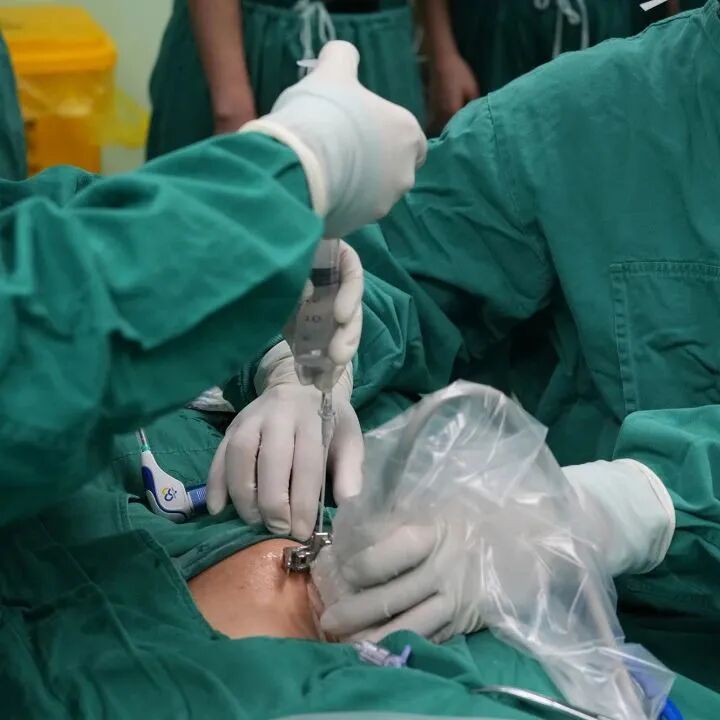 妇科微波是什么新技术推介 ｜ “针”微创 不开刀——我院成功开展首例超声引导下经皮子宫肌瘤微波消融术_https://www.jmylbn.com_新闻资讯_第2张