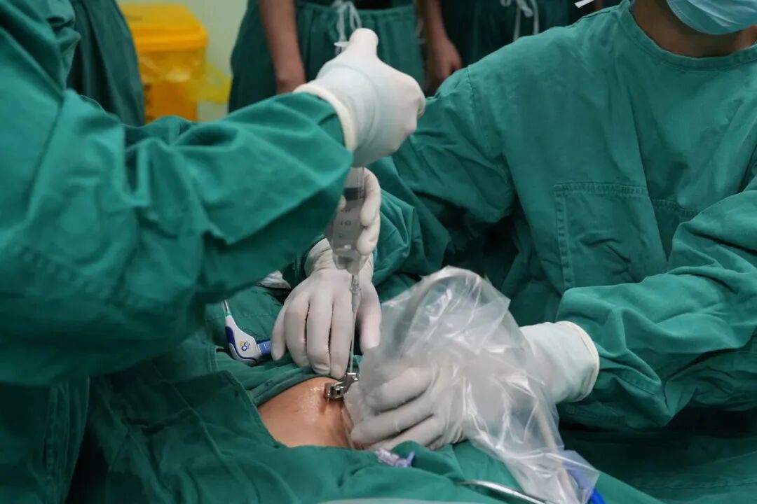 妇科微波是什么新技术推介 ｜ “针”微创 不开刀——我院成功开展首例超声引导下经皮子宫肌瘤微波消融术_https://www.jmylbn.com_新闻资讯_第6张