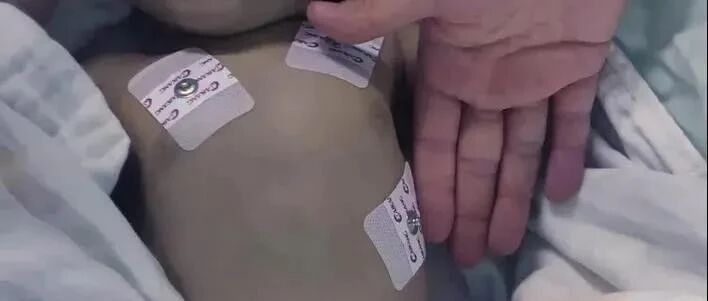 2名宝宝被活活喂到中毒，全身发紫！惊动央视：别再这样养孩子了！