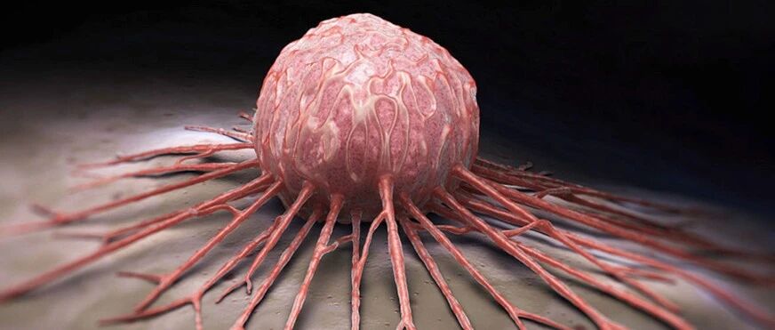 医生才知道的防癌知识，记住这10条！癌症远离我！