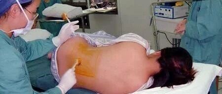 产后腰疼怎么办？送你免费康复四招！