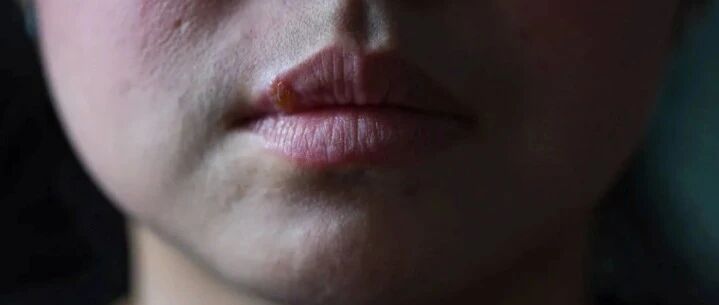 为什么都说备孕时就要把牙齿看好？因为有孕妈就因为一颗牙，痛失宝宝！