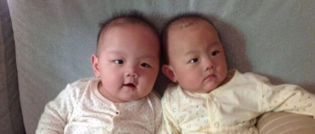 试管婴儿可以做龙凤胎吗？