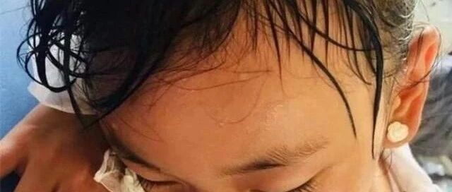 孩子睡觉满头汗，可能是缺这个，赶紧补上吧！