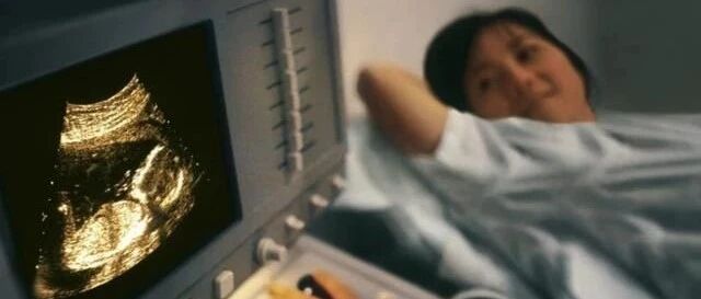 太神奇！10张照片演示胎儿的性别是如何形成的？