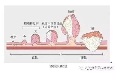 fh染色是什么意思直肠癌筛查——FH检测技术_https://www.jmylbn.com_新闻资讯_第2张