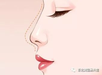 鼻炎的早期症状及危害！它与感冒有何区别？？？