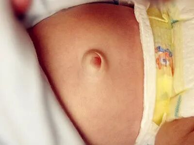 新生儿肚脐夹怎么打开新生儿宝宝的脐带什么时候脱落？肚脐的日常消毒怎么做？_https://www.jmylbn.com_新闻资讯_第23张