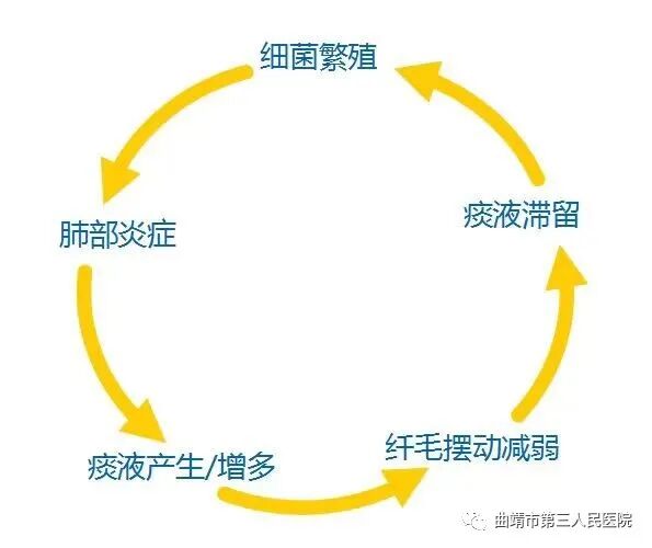排痰机器怎么排如何利用机械辅助排痰_https://www.jmylbn.com_新闻资讯_第4张